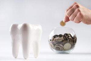 Dental Implant Financing Options