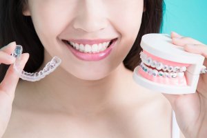 girl holding invisalign and model of braces in hands